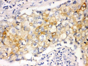 Anti-Involucrin, clone SY-5