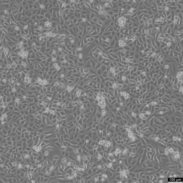 NCI-H1703 Cells