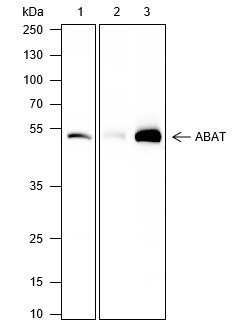 Anti-Recombinant ABAT, clone A395