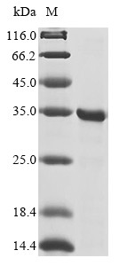 Egl nine homolog 1 (EGLN1), partial, human, recombinant