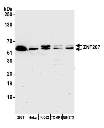 Anti-ZNF207