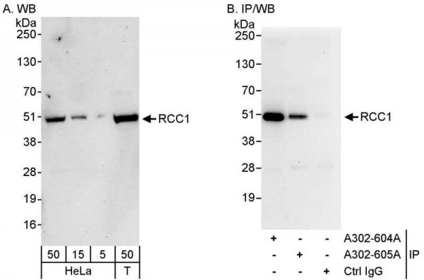 Anti-RCC1