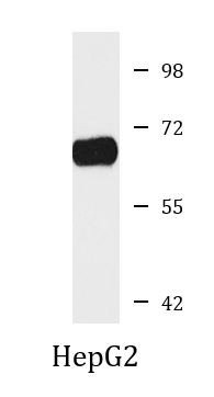 Anti-Complement C8 beta chian
