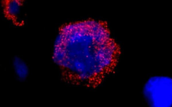 Anti-BCR (IHC)