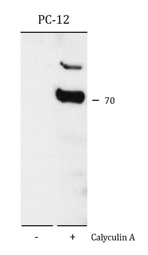 Anti-phospho-DPYSL2 / CRMP2 (Thr555)