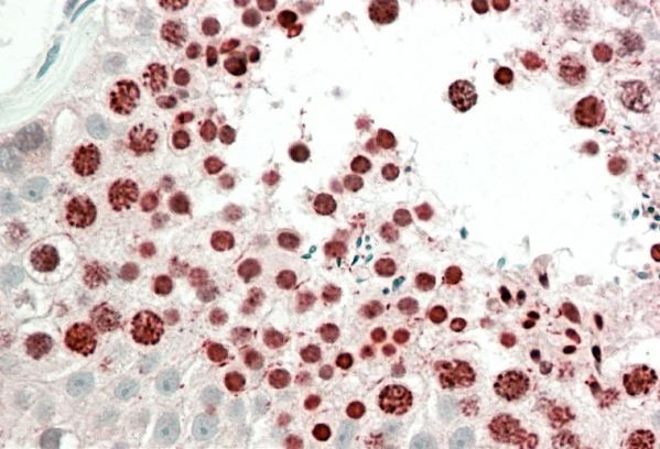 Anti-HOXA10