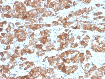 Anti-Luteinizing Hormone beta, clone LHb/1612R