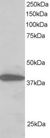 Anti-NIPP1 / PPP1R8, C-terminal