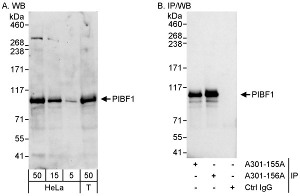 Anti-PIBF
