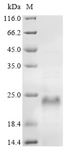 Nascent polypeptide-associated complex subunit alpha (NACA), human, recombinant