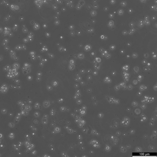 EB3 Cells