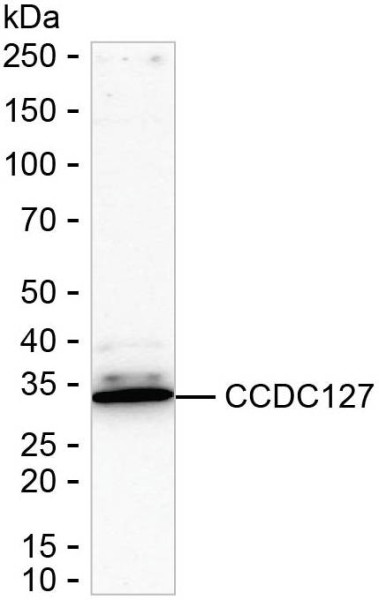 Anti-CCDC127