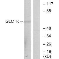 Anti-GLYCTK
