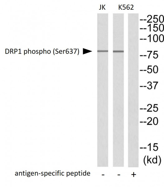 Anti-phospho-DNM1L / DRP1 (Ser637)