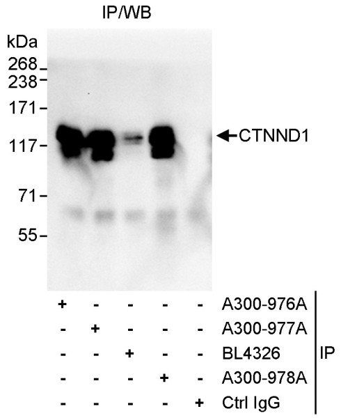 Anti-CTNND1