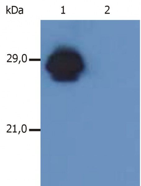 Anti-HLA-DR + HLA-DP, clone MEM-136
