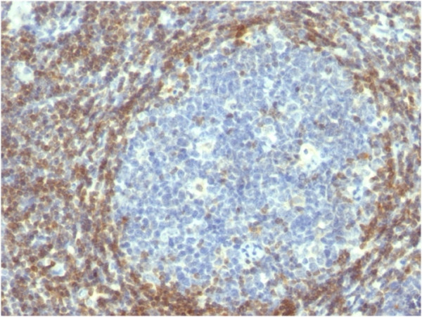 Anti-Bcl-2 (Apoptosis &amp; Follicular Lymphoma Marker), clone BCL2/782