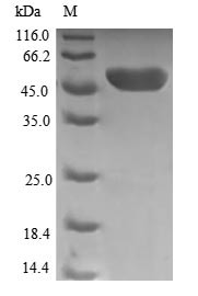 Thiamin pyrophosphokinase 1 (TPK1), human, recombinant