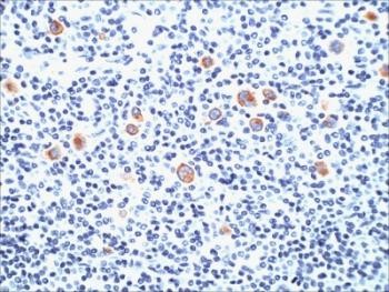 Anti-CD15 (SSEA-1, FUT4), clone SPM490