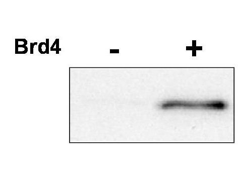 Anti-phospho-Cyclin-Dependent Kinase 9 (CDK9) (Thr29)