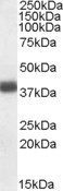 Anti-APOL2, C-terminal