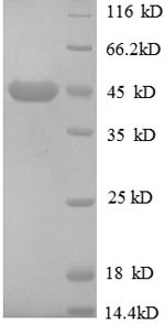 Cation-independent mannose-6-phosphate receptor (IGF2R), partial, human, recombinant