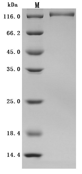 Ectonucleotide pyrophosphatase/phosphodiesterase 3 (ENPP3), partial (Active), Macaca fascicularis, r