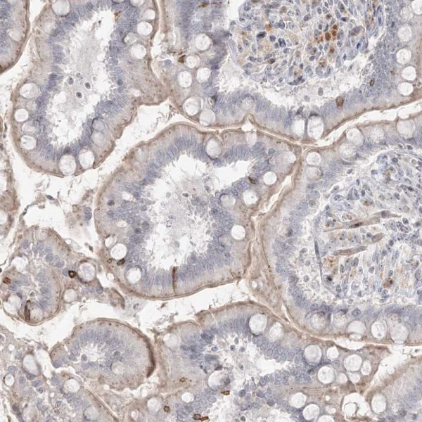 Anti-SH3BP4