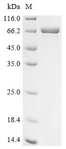 DCC-interacting protein 13-alpha (APPL1), partial, human, recombinant