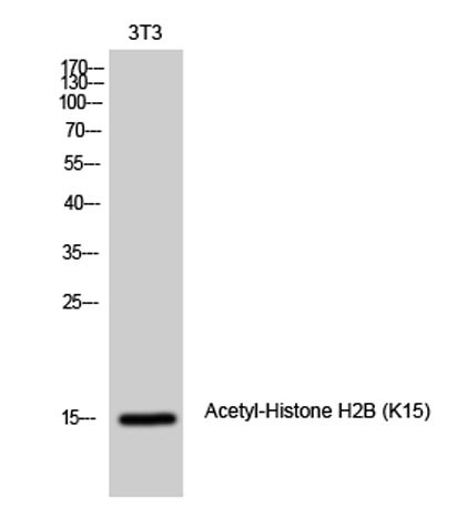 Anti-acetyl-Histone H2B (Lys15)
