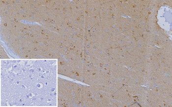 Anti-CXCR5 / Follicular homing receptor, clone CXCR5/13099