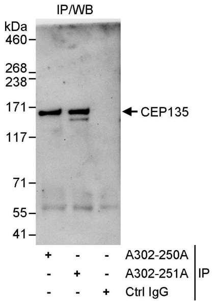 Anti-CEP135