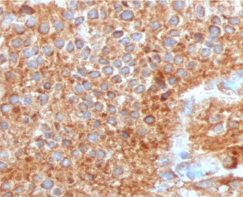 Anti-Uroplakin 1A / UPK1A, clone TTSP21-1