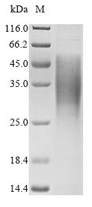 Gap junction alpha-1 protein (Gja1), partial, mouse, recombinant