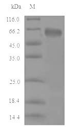 Cystathionine beta-synthase (Cbs), mouse, recombinant