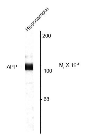 Anti-Amyloid Precursor Protein