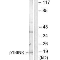 Anti-CDKN2C