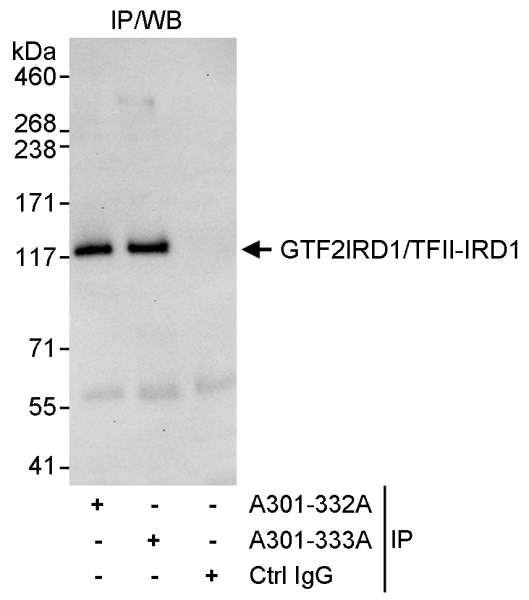 Anti-GTF2IRD/TFII-IRD1