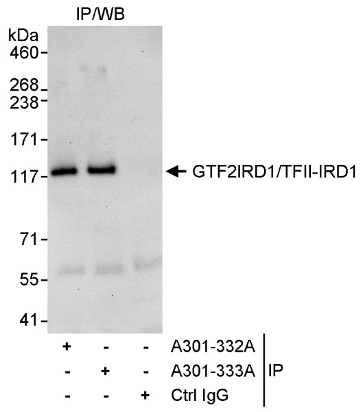Anti-GTF2IRD/TFII-IRD1