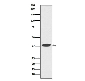 Anti-DNA Polymerase beta / POLB, clone ACGH-16