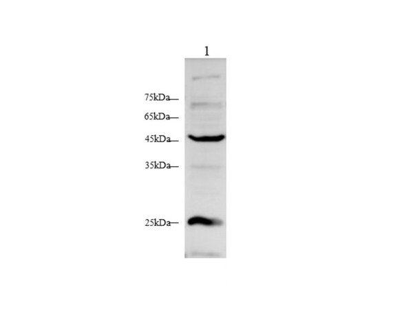Anti-ACTalpha2