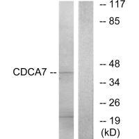 Anti-CDCA7