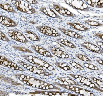 Anti-MUC5B