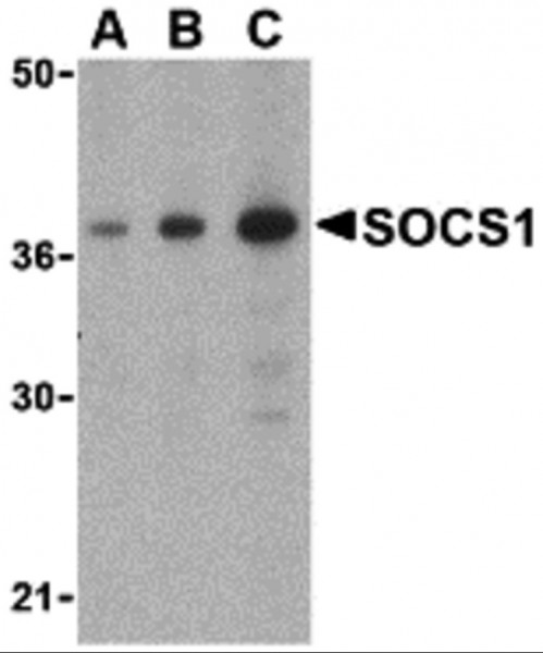Anti-SOCS1