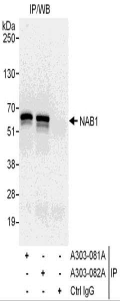 Anti-NAB1