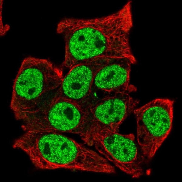 Anti-TCFL5