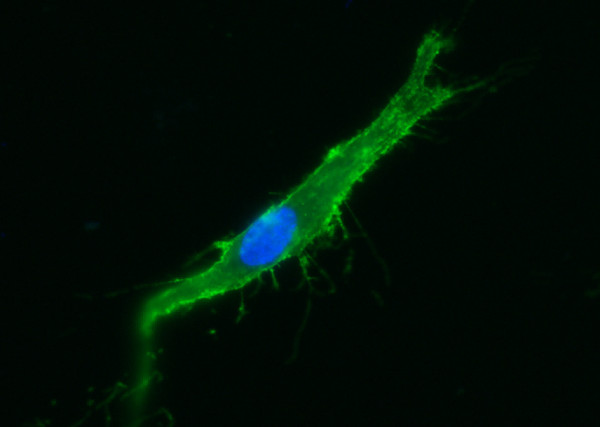 Anti-ICAM-1/CD54 Monoclonal Antibody