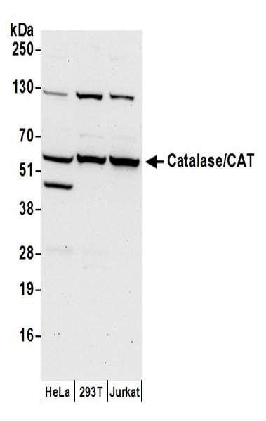 Anti-Catalase/CAT