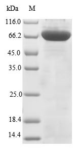 Terminal nucleotidyltransferase 4B (TENT4B), human, recombinant