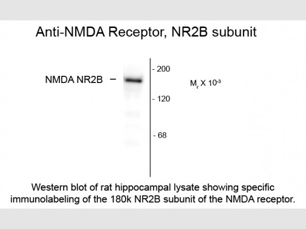Anti-NMDA NR2B Subunit